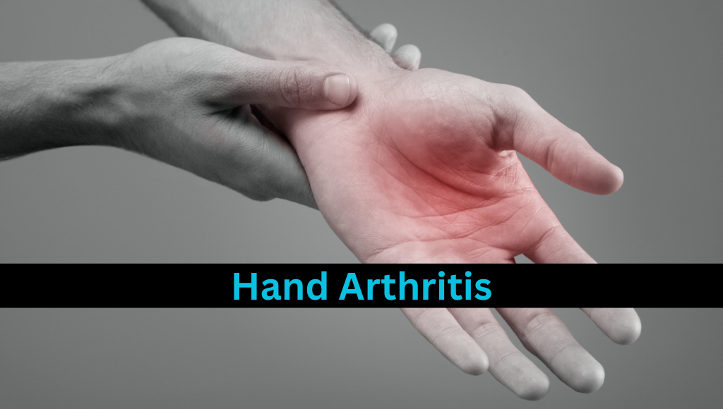 Hand Arthritis