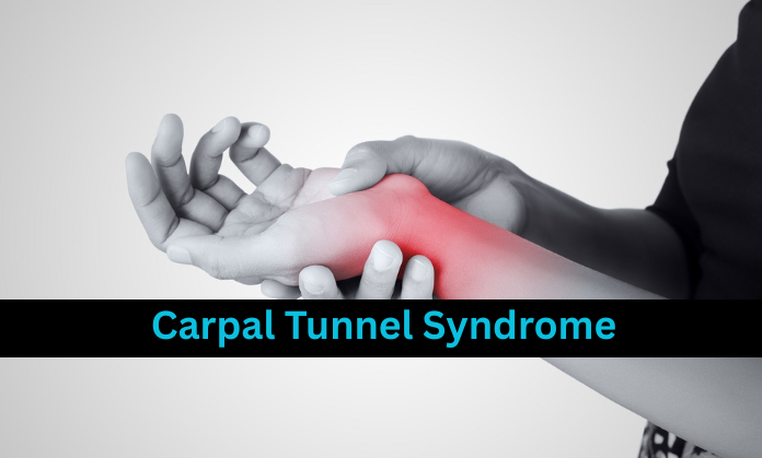 Carpal Tunnel Syndrome